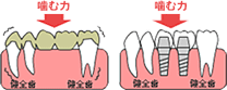 他の治療との比較